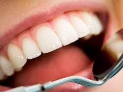 Igiene orale: perchè è importante fare la pulizia dentale regolarmente